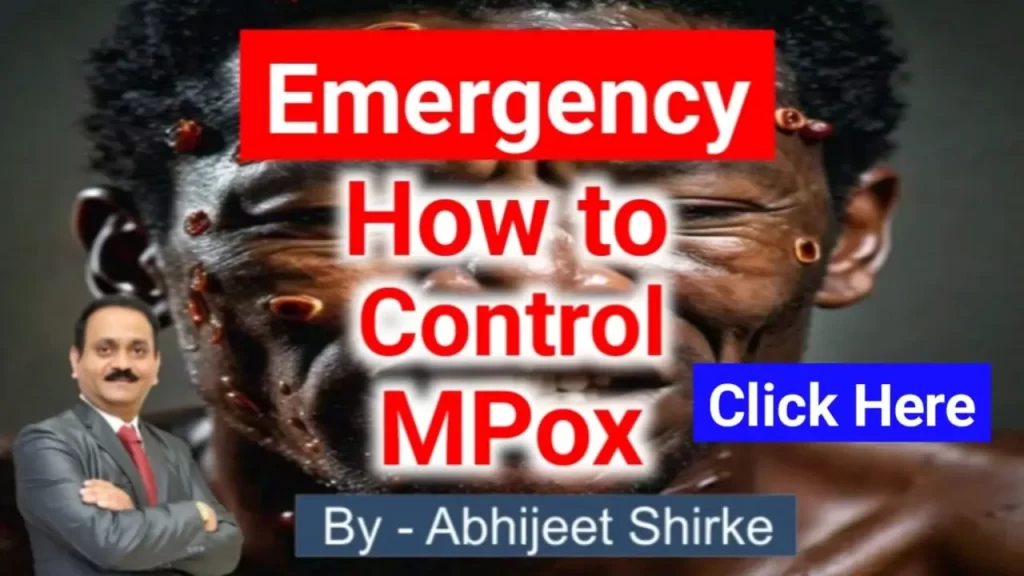 how to control mpox disease